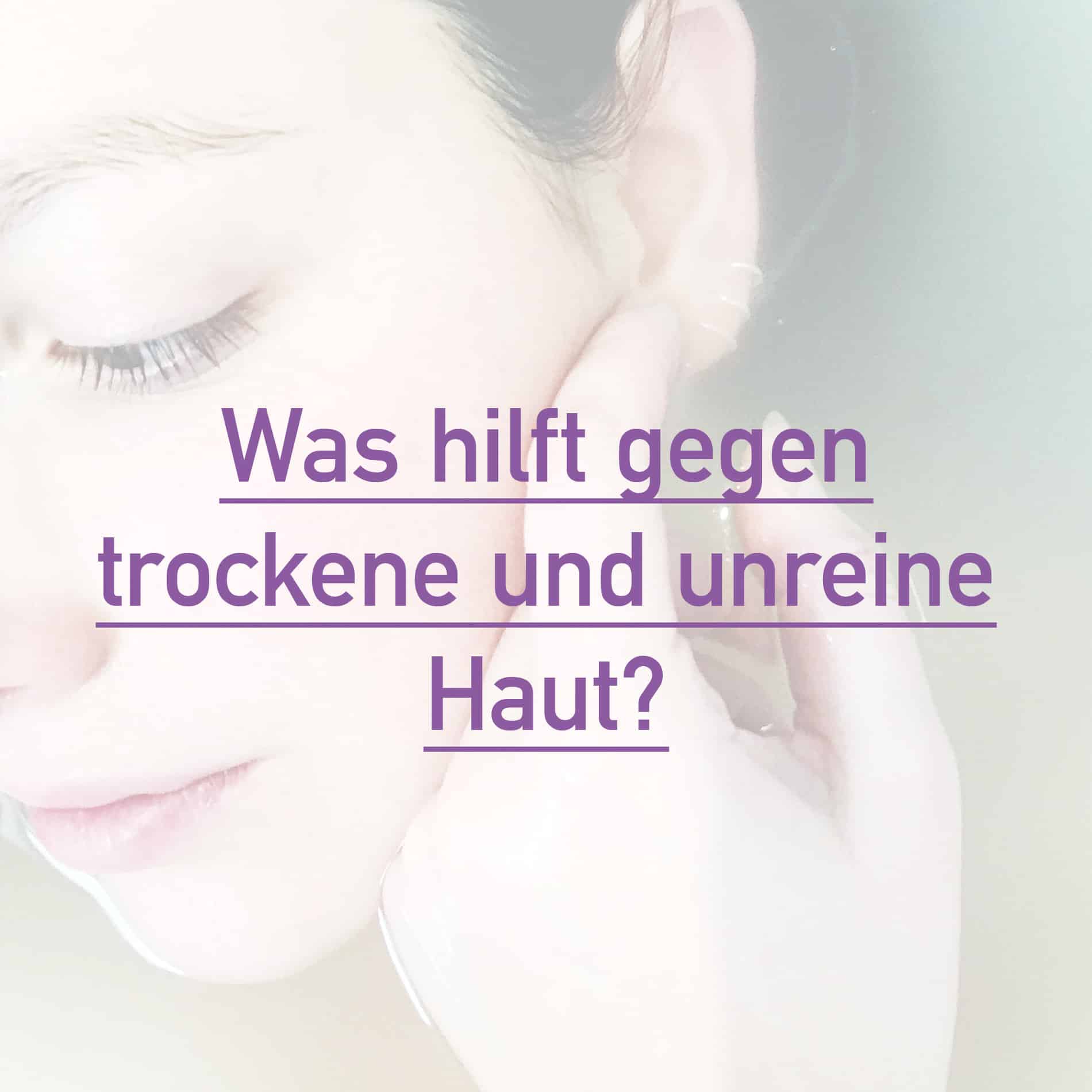 trockene unreine Haut, Creme für trockene unreine Haut, Reinigung trockene unreine Haut, Beauty Tipps für trockene unreine Haut, trockene Haut, unreine Haut, Hautpflegetipps, Beauty Blog, trockene Haut mit Pickeln, was hilft gegen trockene unreine Haut